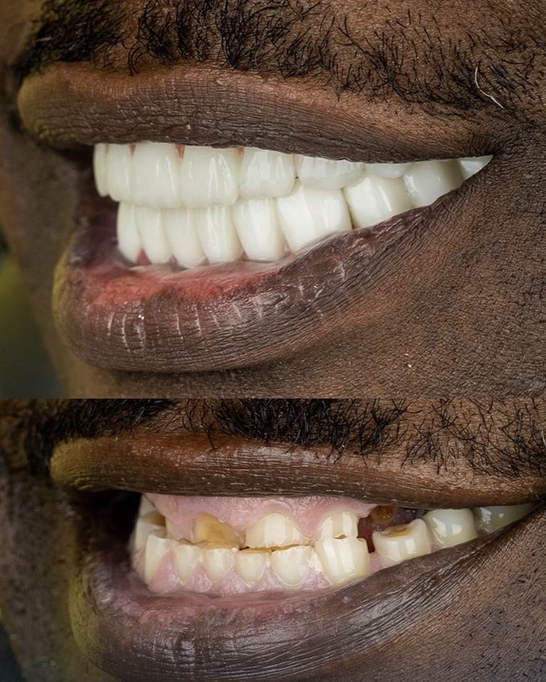 CBCT 3D X-ray